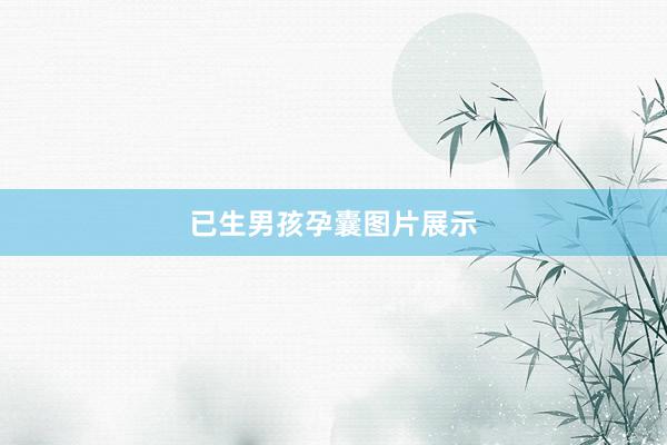 已生男孩孕囊图片展示